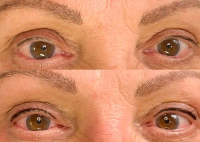 Permanent Makeup Eyeliner Before and After