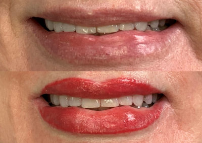 Permanent Makeup Lip color Before and after